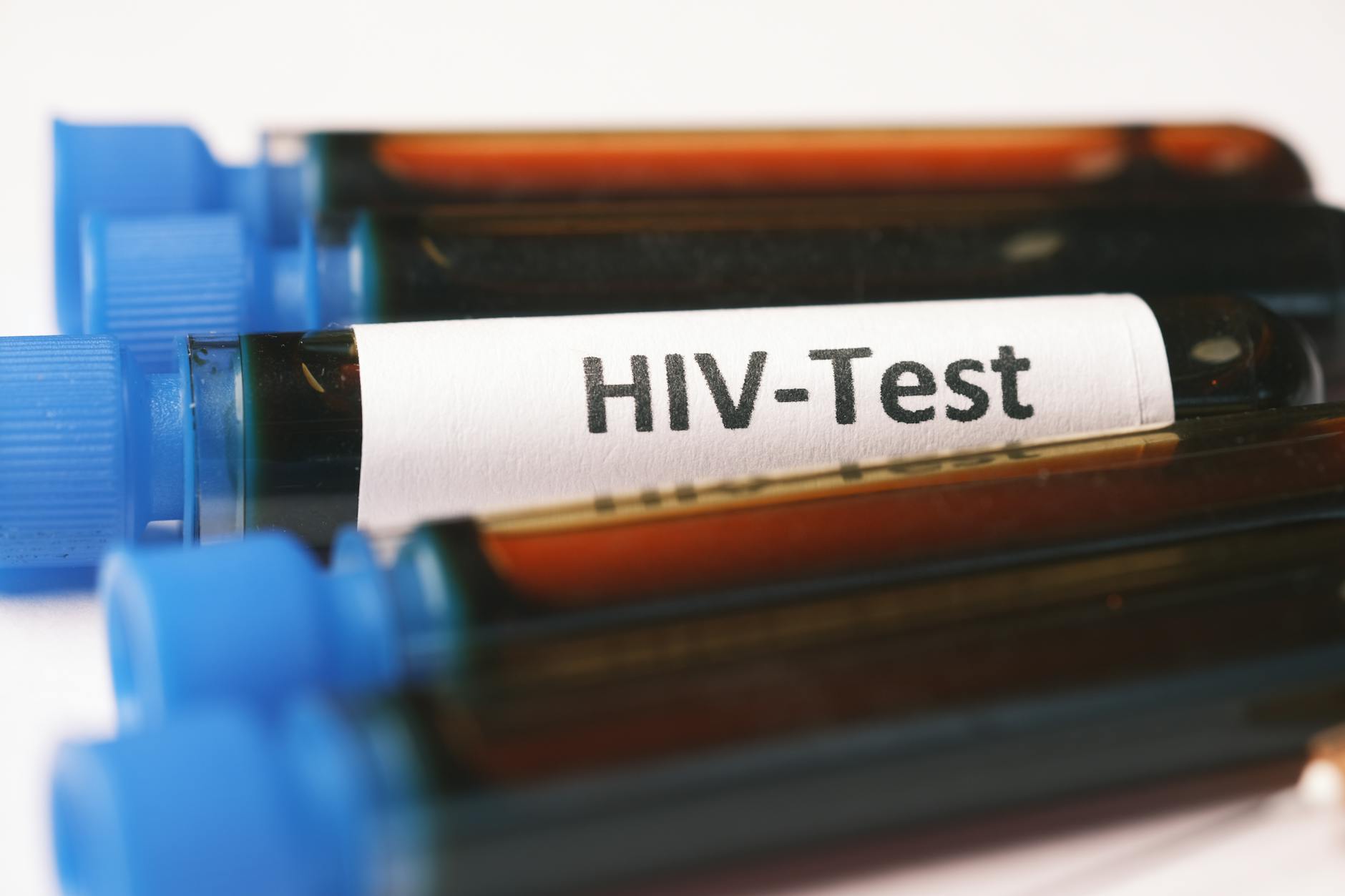 Probówki z krwią opisane jako próbki do testów HIV