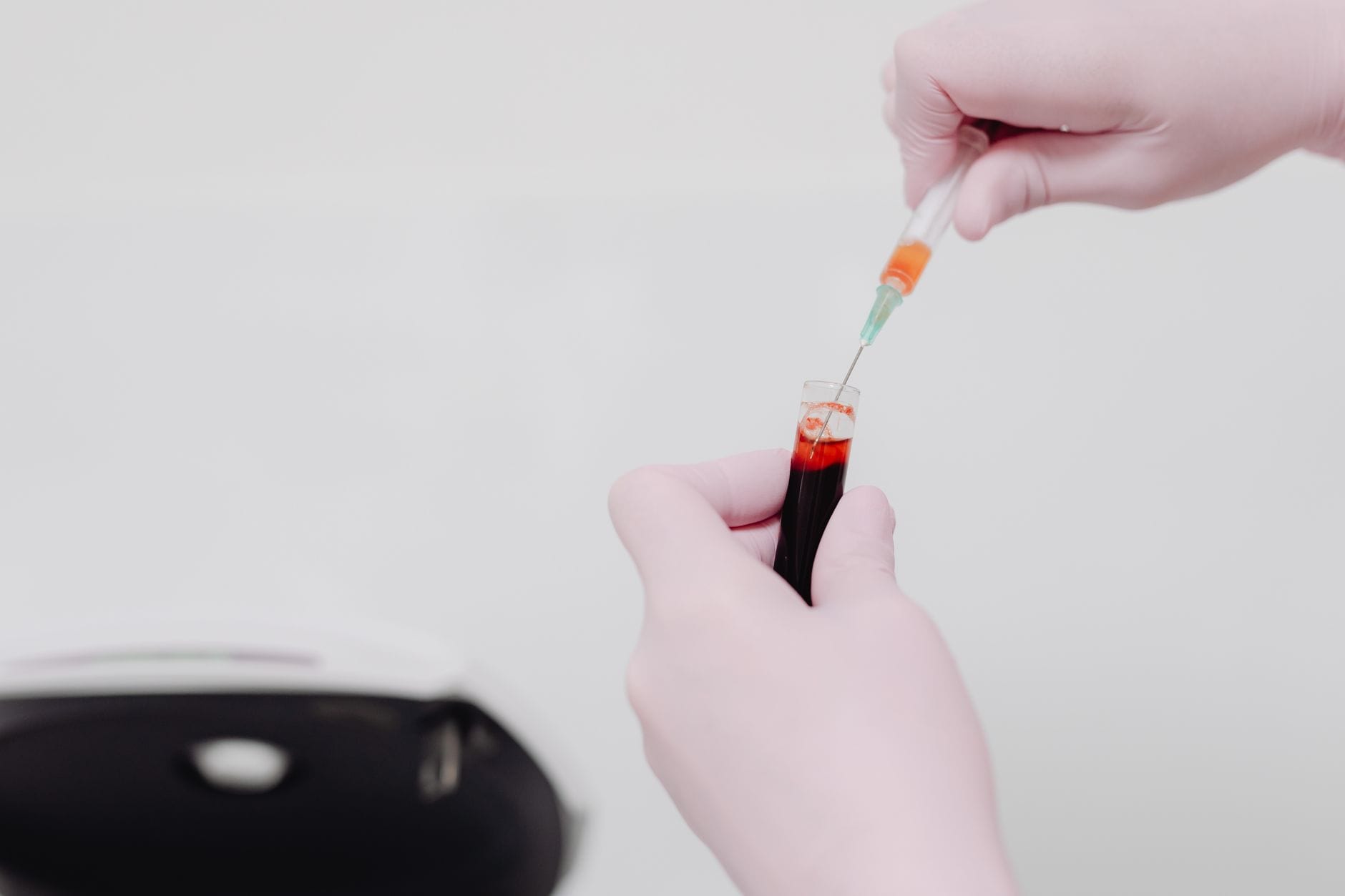Laborant z probówką krwi przygotowuje próbkę do analizy laboratoryjnej