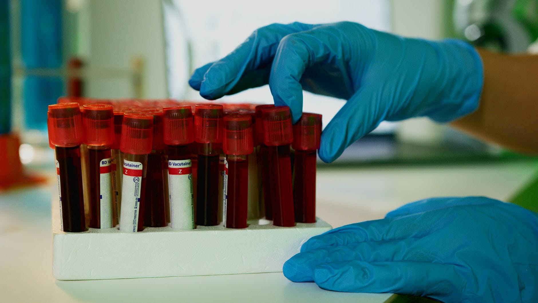 Laborantka trzyma probówki z krwią podczas analizy laboratoryjnej HIV
