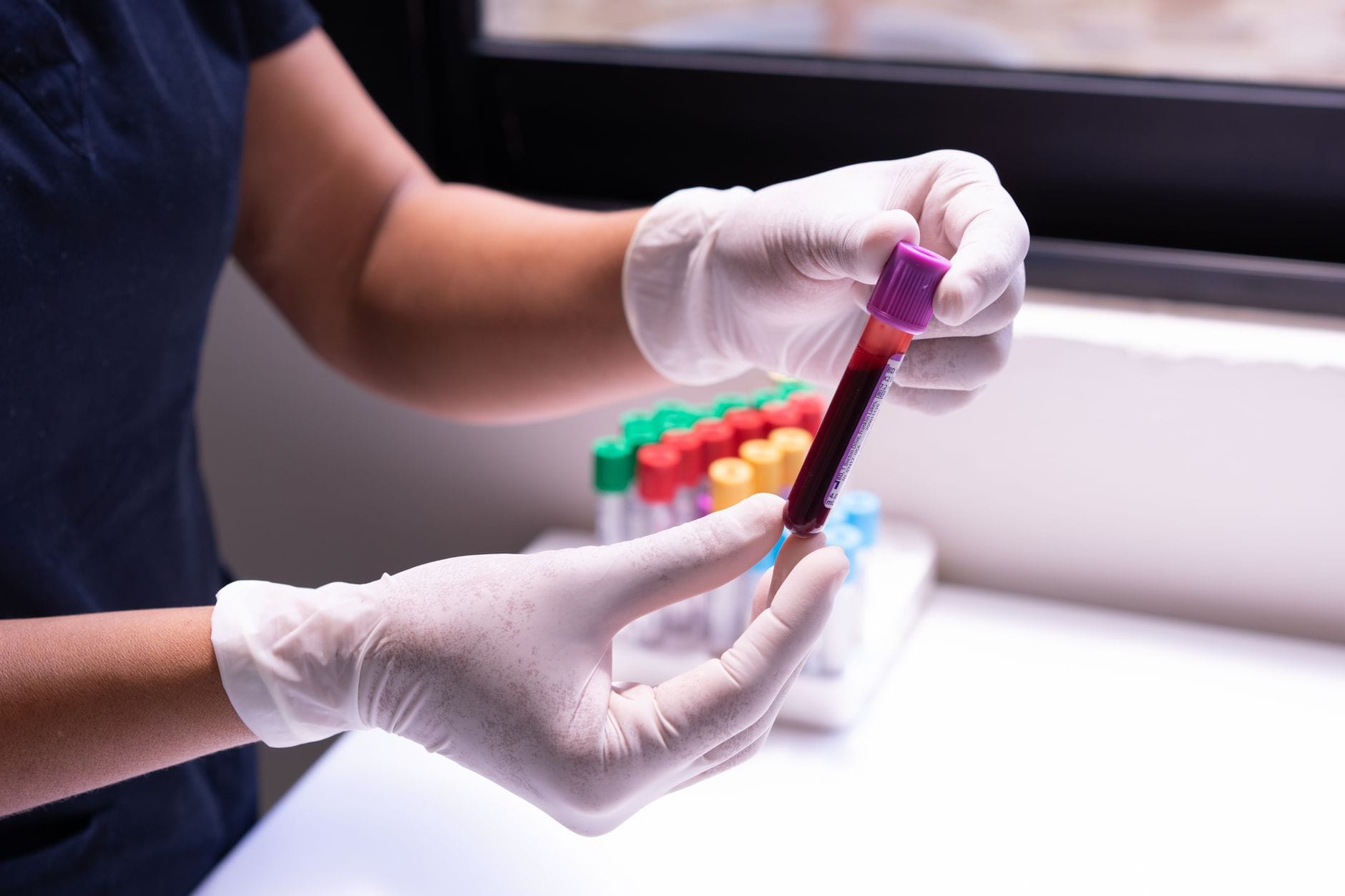 Ręce w rękawiczkach trzymają probówkę z krwią w laboratorium